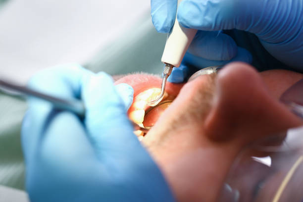 Best Emergency Dental Extractions in Metropolis, IL