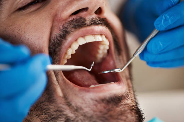 Best Urgent Dental Care for Toothache in Metropolis, IL